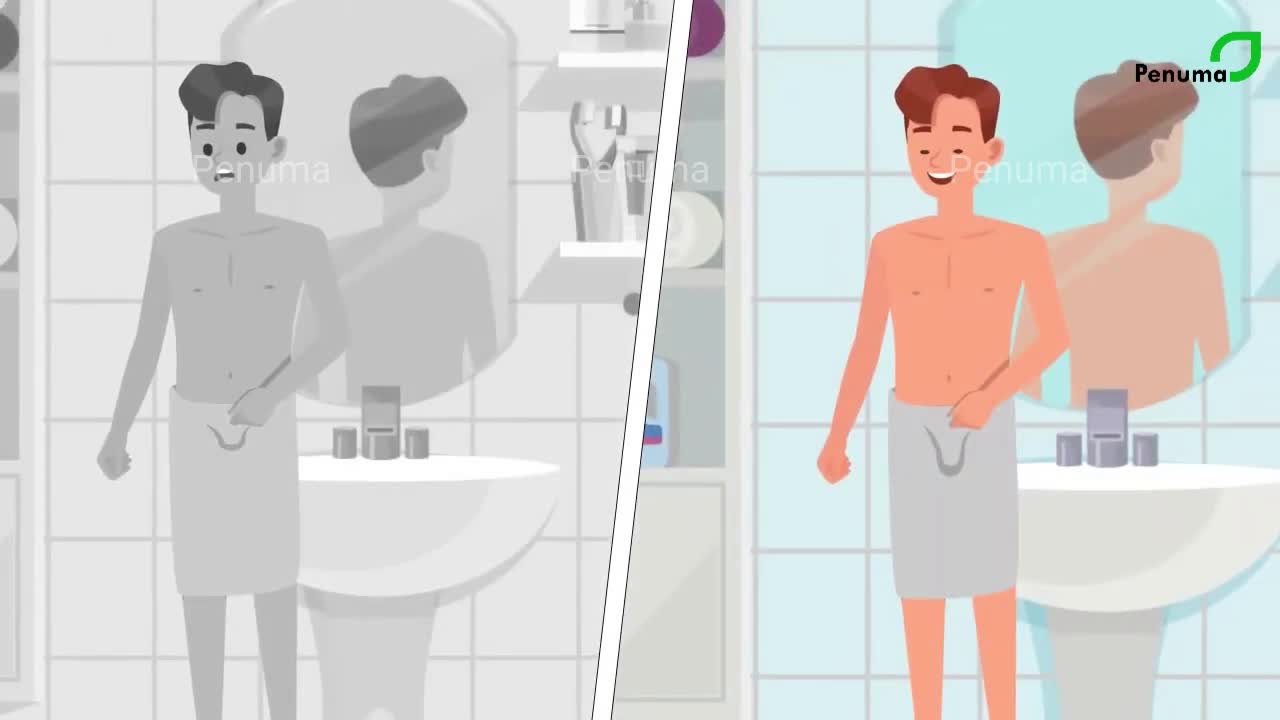 Lợi ích và những điều cần biết về độn dương vật Penuma