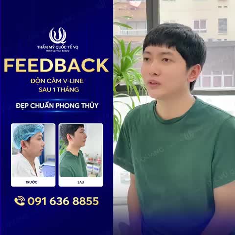 K.H Review Độn cằm Vline - Cằm phong thủy – Tướng thêm sang tại Thẩm mỹ quốc tế VQ.
