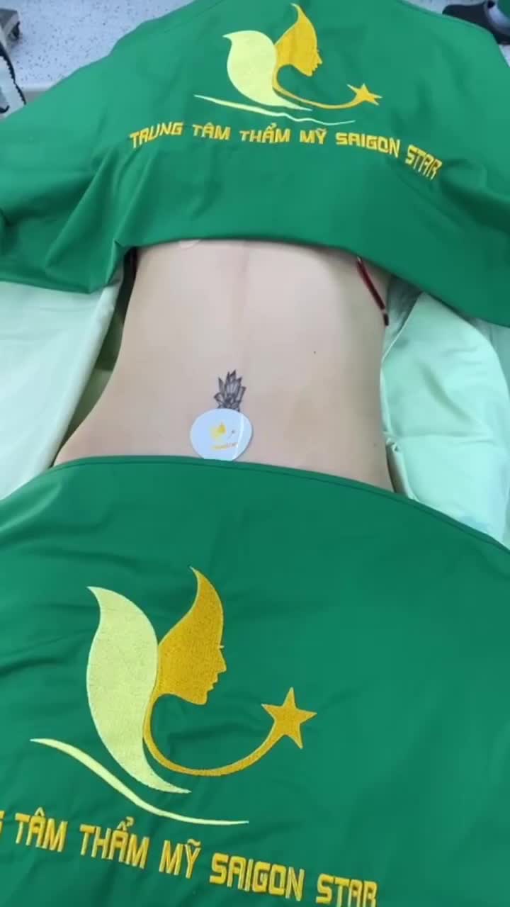 Mãn nhãn kết quả hút mỡ bụng căng da của chị khách Việt kiều Singapore vừa được bác sĩ Hoạt thực hiện xong