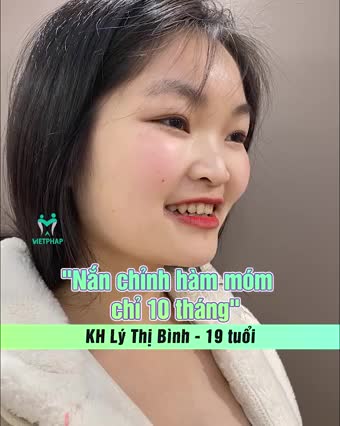 Thì ra .... răng đẹp ... là vì..... Chỉnh nha