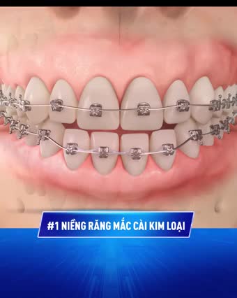 HÔ THƯA MÓM KHẤP KHỂNH