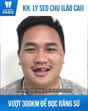 Thật may được người chị giới thiệu, anh Chu biết đến nha khoa Paris là thương hiệu uy tín toàn quốc và đã phải lòng ngay lần đầu tiên.