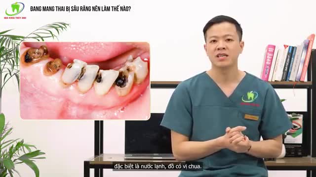 XỬ LÝ RĂNG SÂU CHO BÀ BẦU