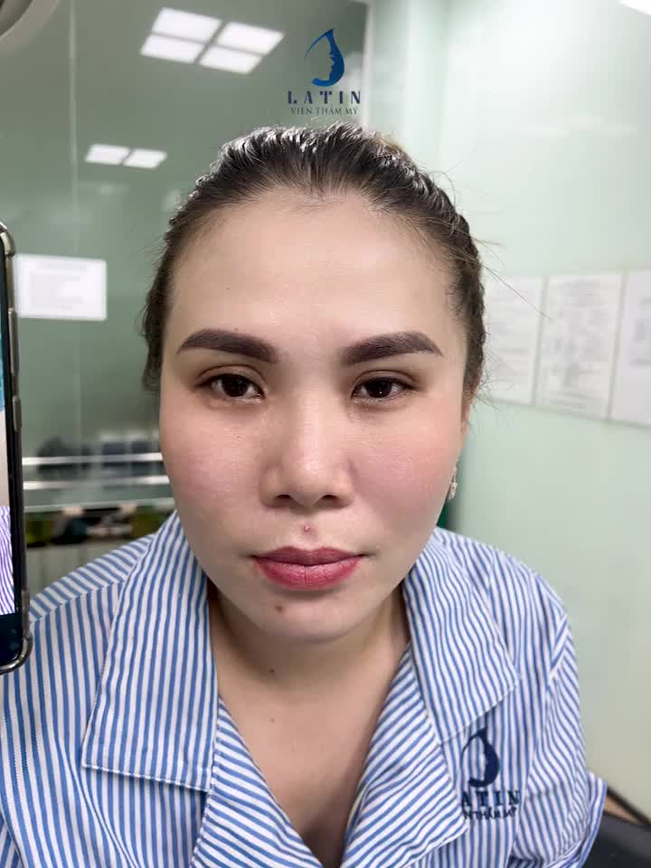 Độn thái dương cho khách hàng đến từ Cà Mau