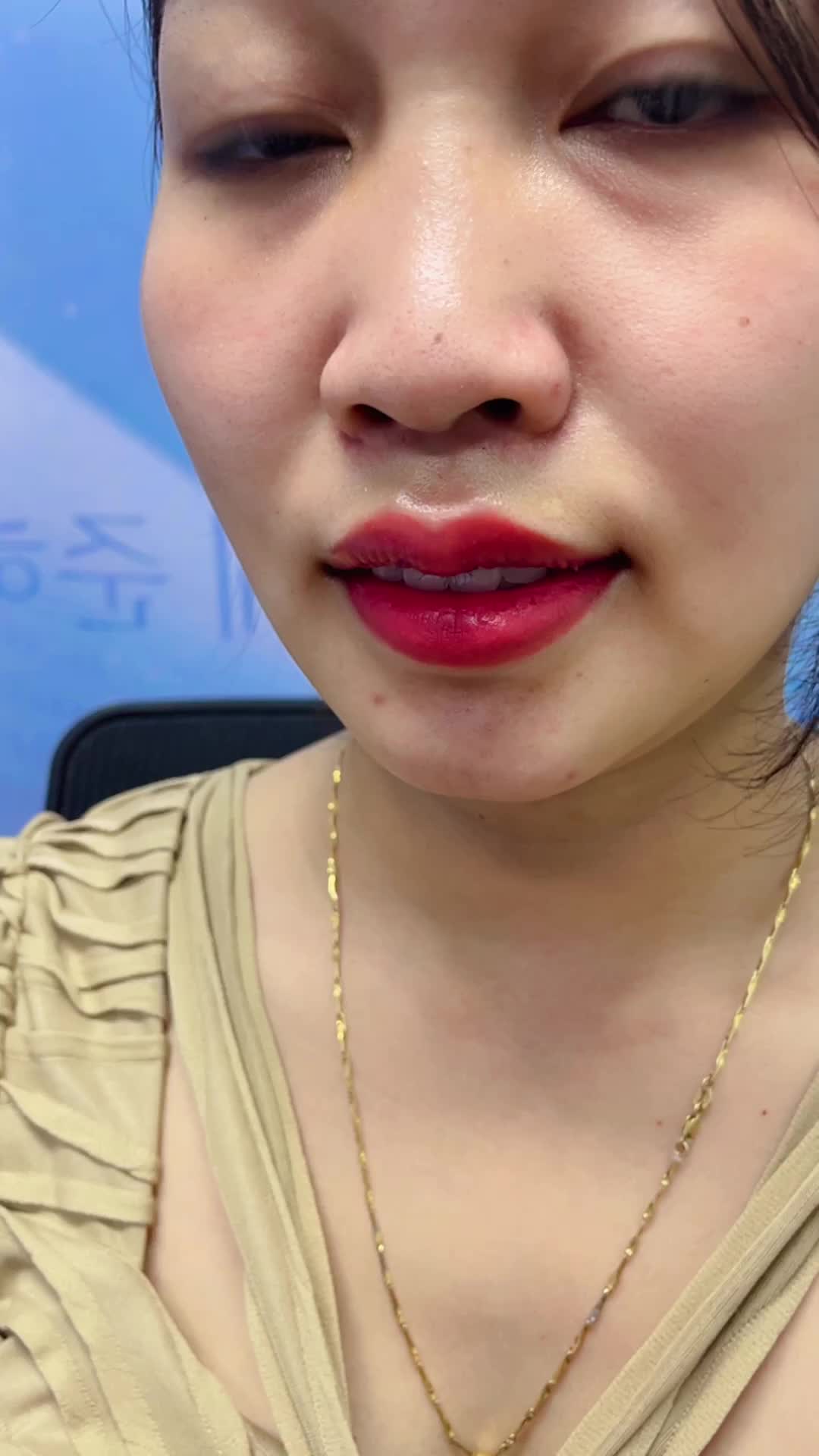 Kết quả TẠO MÔI TIM sau 5 ngày
