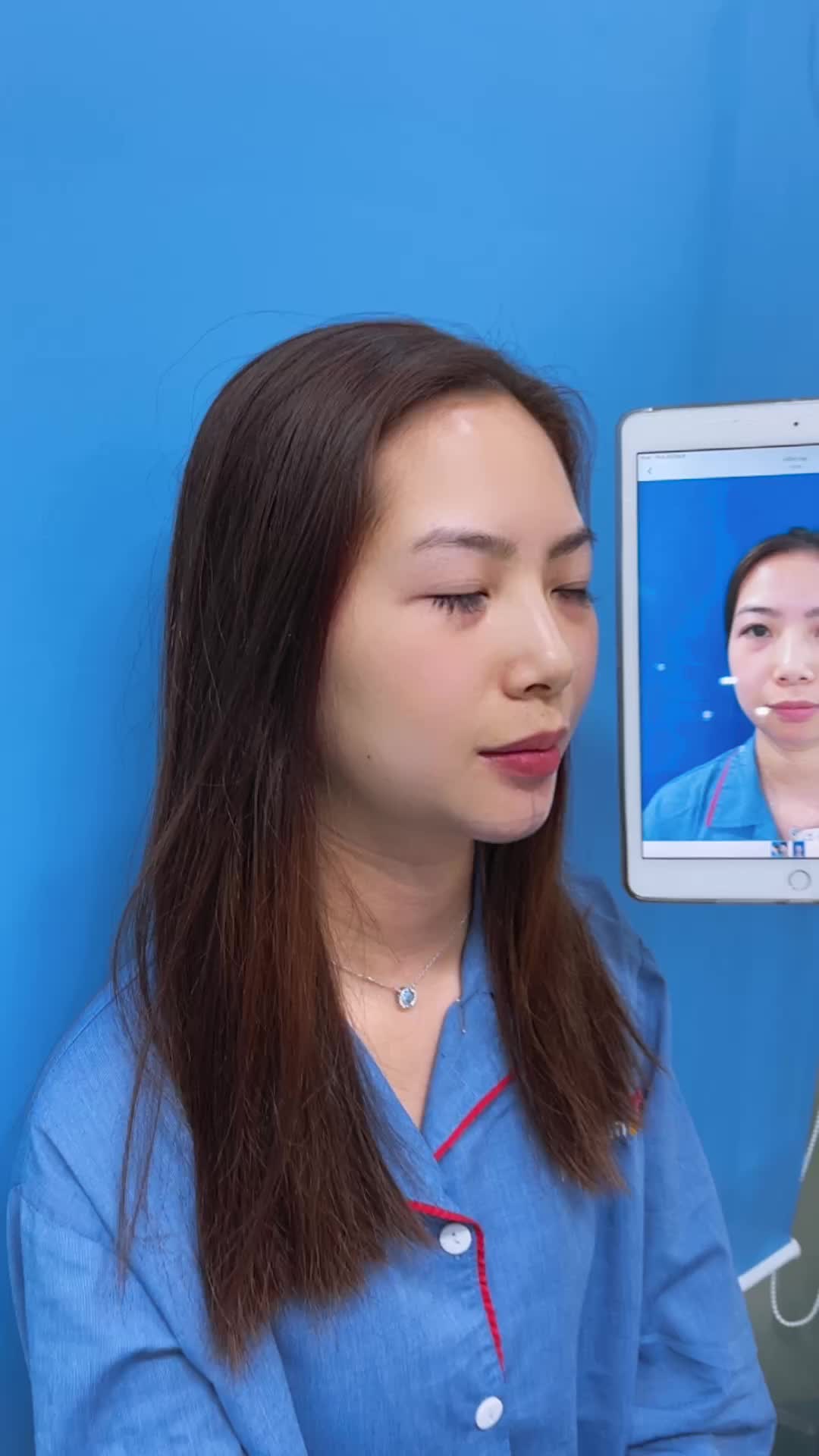Không tới 1h đồng hồ - Sở hữu ngay gương mặt cân đối với chiếc cằm tỉ lệ vàng quá ưng ý