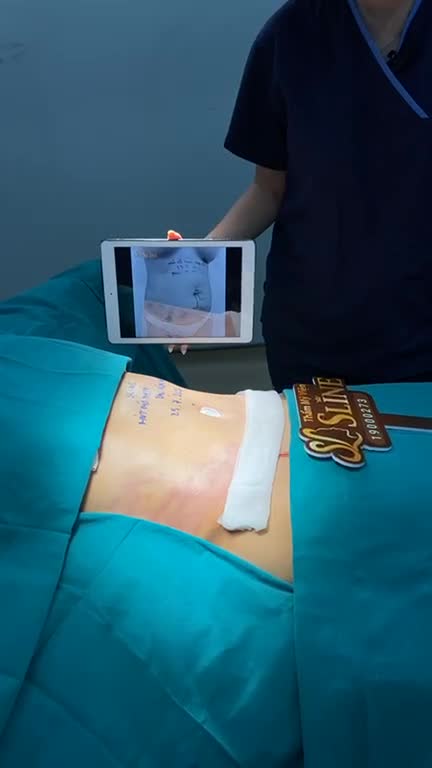 BỤNG MỠ HOÁ BỤNG CƠ SAU 2 GIỜ
