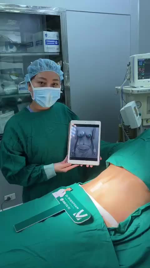Ca Combo Hút mỡ tạo hình thành bụng + Ngâng ngực vừa được thực hiện bởi ekip Dr. Minh Phạm