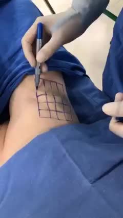 VIÊM MÀNG CÁNH NẶNG MÙI - chữa bằng cách nào
