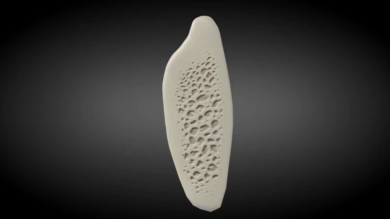 Khi có bác sĩ sẽ chỉ định ghép xương (bồi xương) để cấy ghép Implant.