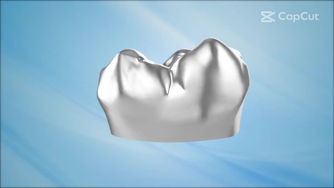 Răng sứ thẩm mỹ là gì
