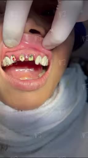 Sai một ly, đi một hàm