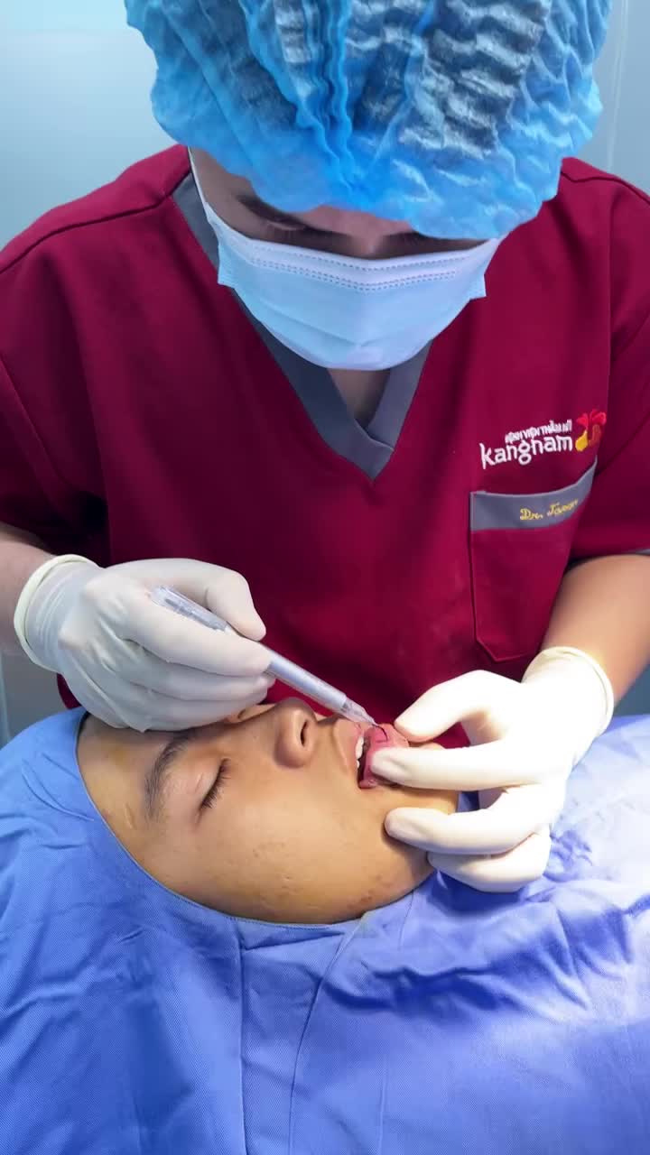 Quá trình phẫu thuật thu mỏng môi tại Kangnam