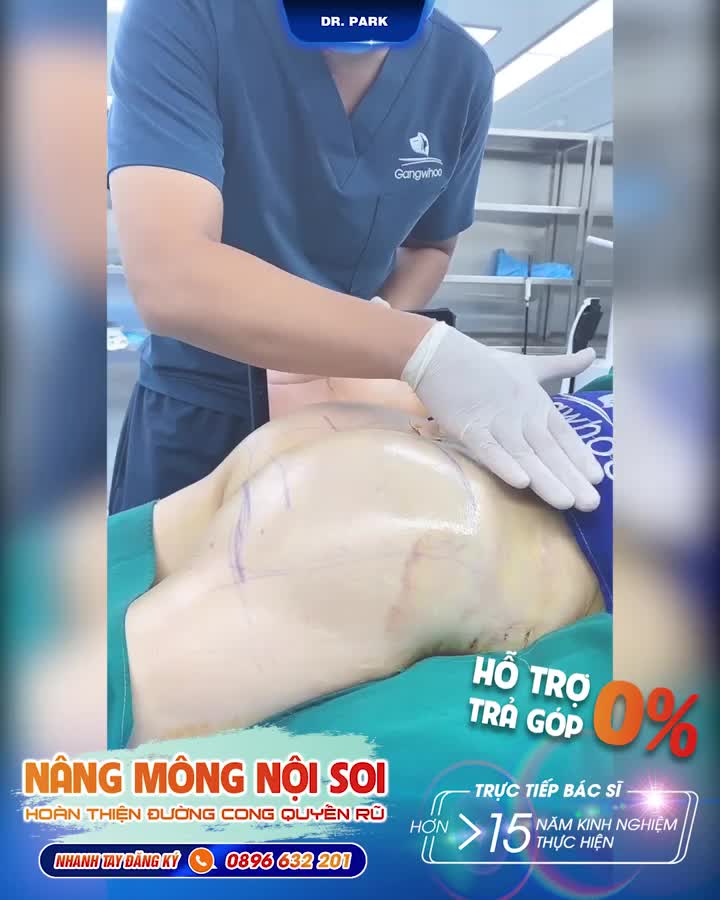 NÂNG MÔNG NỘI SOI VÀ NHỮNG ĐIỀU CẦN BIẾT!