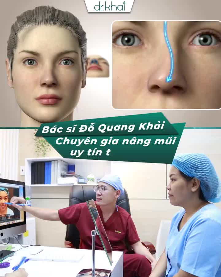 ƯU ĐÃI ĐẶC BIỆT NÂNG MŨI GIẢM NGAY 5 TRIỆU BÁC SĨ KHẢI CAM KẾT