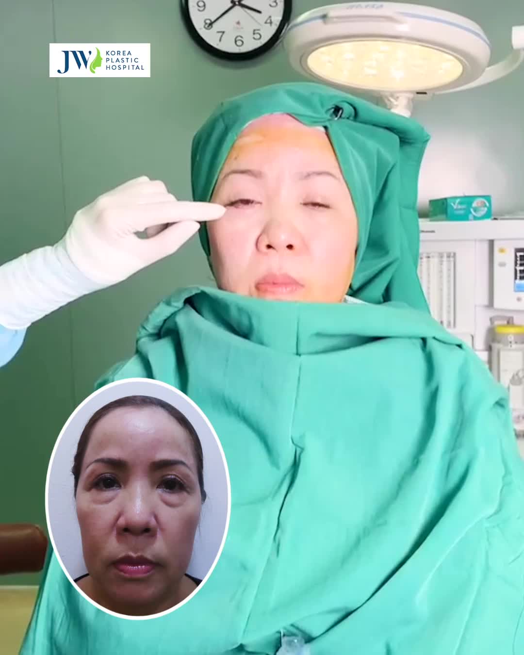 NGƯỢC DÒNG THỜI GIAN Cải lão gương mặt 3M TRẺ 20 TUỔI, Quý bà U50 HÚ HỒN hóa thân thành Quý cô U30