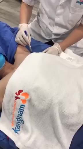 Quy trình đo vẽ trị hôi nách vĩnh viễn Endo Dry