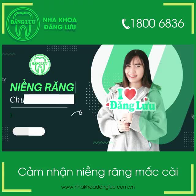 Cảm nhận niềng răng của bạn Trần Lê Phi Yến