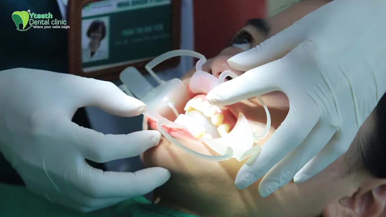 CHUẨN NHA KHOA QUỐC TẾ