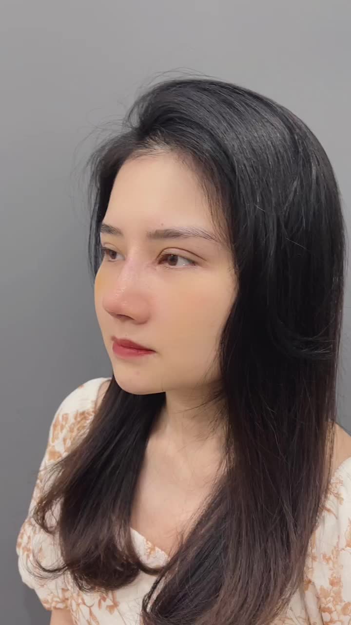 LỘT XÁC VỚI COMBO NÂNG MŨI CẤU TRÚC CHỈNH XƯƠNG  kết hợp CẮT MÍ TRÊN, MỞ GÓC TRONG NGOÀI