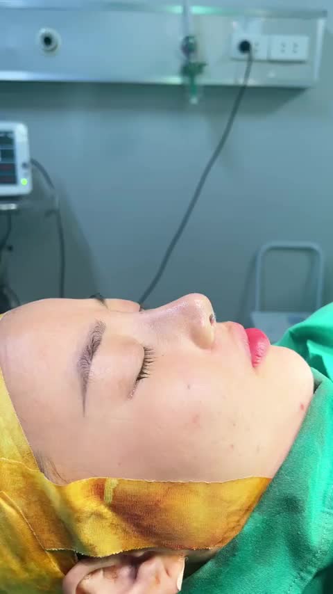 Khách hàng vừa nâng mũi