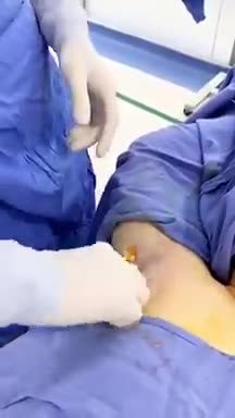 VẤN NẠN “ RAU MÙI VÙNG NÁCH” SẼ ĐƯỢC DẬP TẮT NGAY LẬP TỨC KHI BẠN ĐẾN KANGNAM