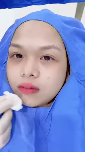 Cô gái Gen Z dễ thương - Đôi môi xinh xắn không may sẹo môi do tai nạn