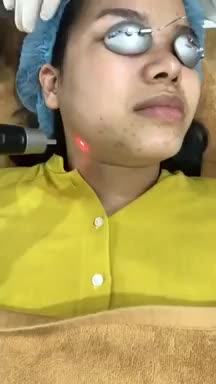 Điều trị THÂM SẸO trong phút chốc hiệu quả dài lâu nhờ Laser Picosure