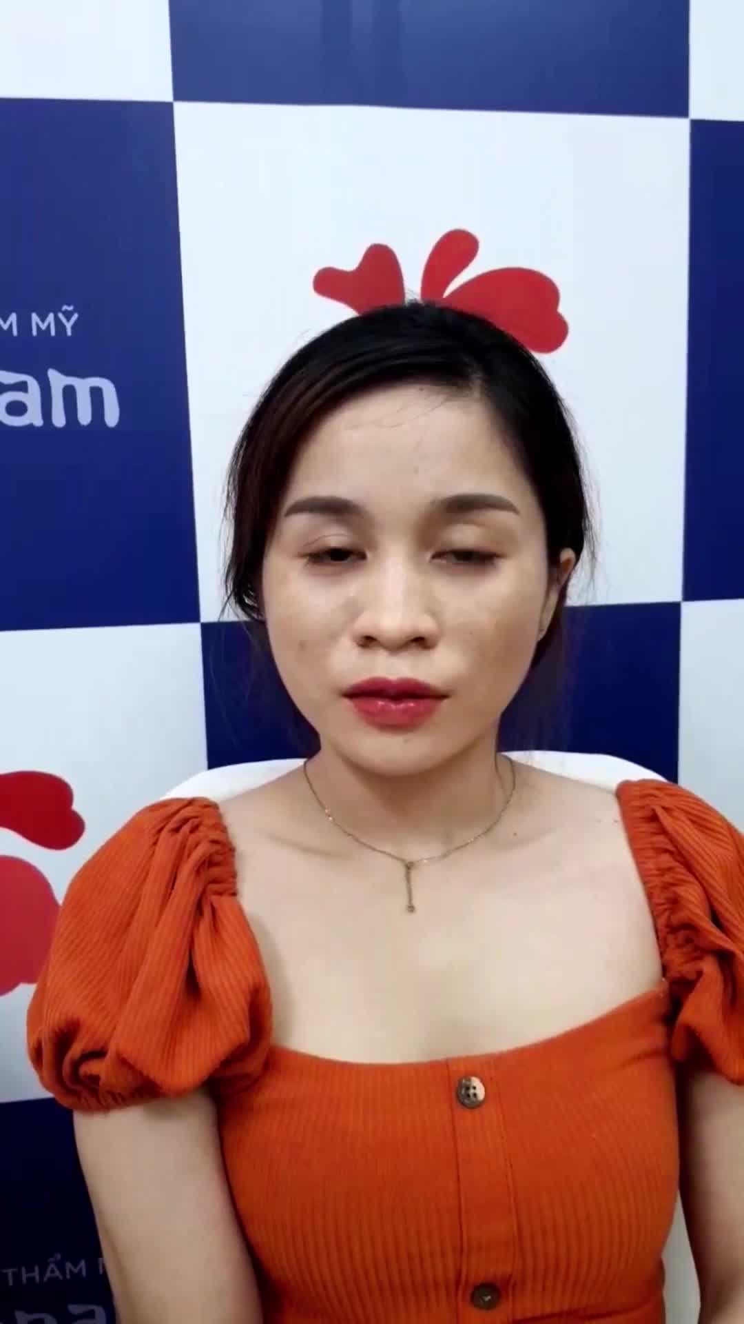 Xinh chưa, xinh chưa!! Khách Tạo môi tim 5 ngày vừa cắt chỉ ạ
