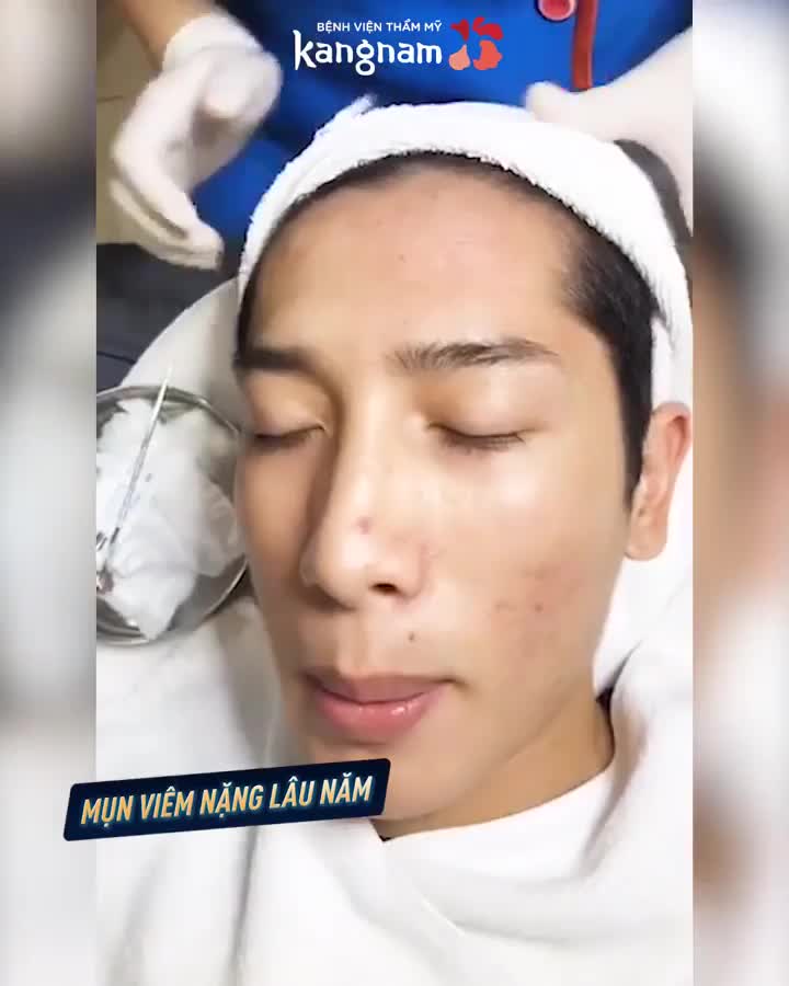"Vài triệu" 1 liệu trình Trị mụn - Có xứng đáng???