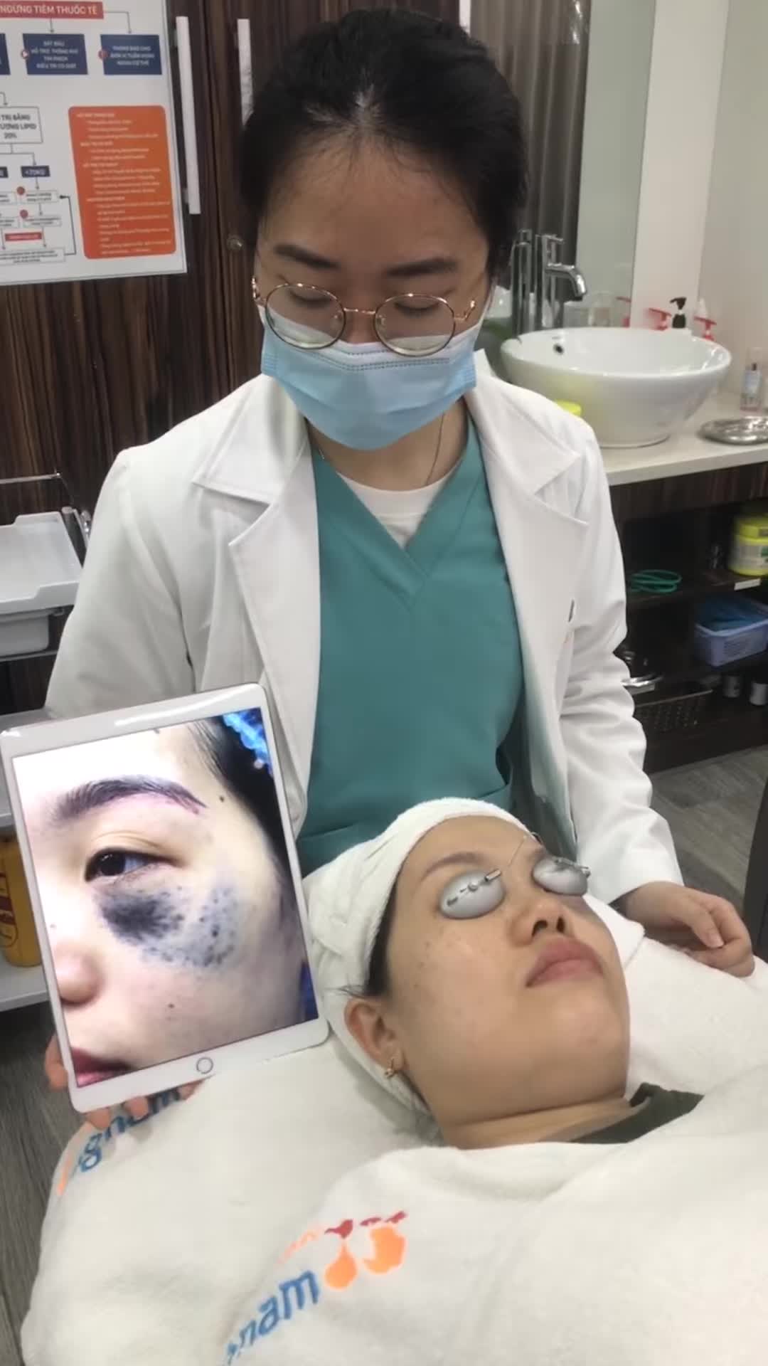 Bớt - Một tình trạng sắc tố da gây mất thẩm mỹ và cực kỳ khó chịu cho các anh chị em
