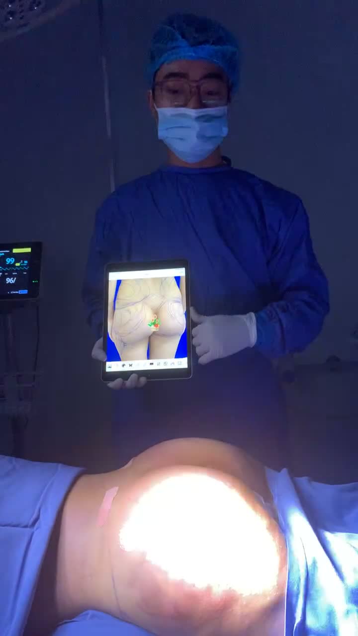 "Chị làm mông trước, xong làm thêm ngực và mũi để ĐẸP vào TẾT đây!"