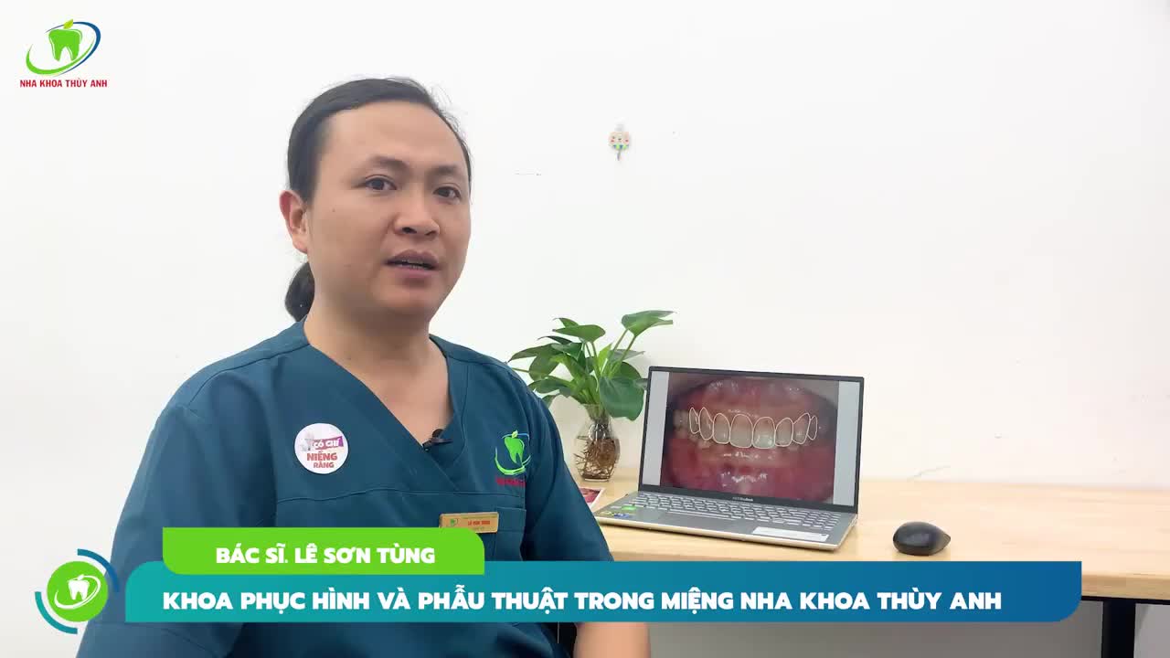 DÁN SỨ VENEER 18 RĂNG - GIẢI CỨU HÀM RĂNG NHIỄM MÀU NẶNG