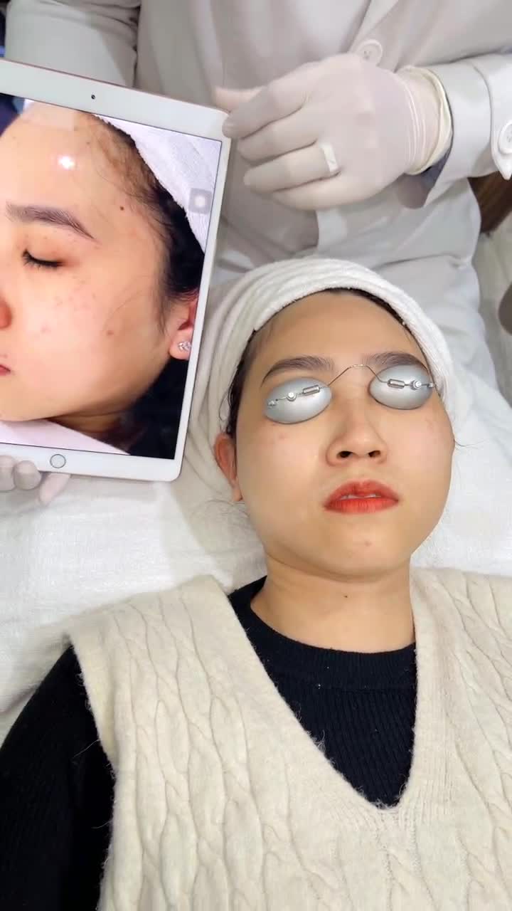 Tận mắt chiêm ngưỡng kết quả điều trị bớt bẩm sinh bằng công nghệ Laser Picosure tại Kangnam