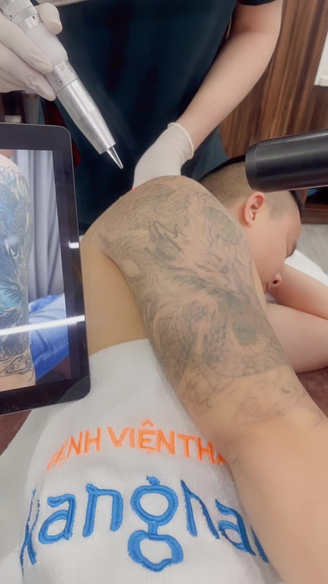 Hiệu quá đáng bất ngờ với 6 buổi xoá xăm với công nghệ Picosure tại Kangnam
