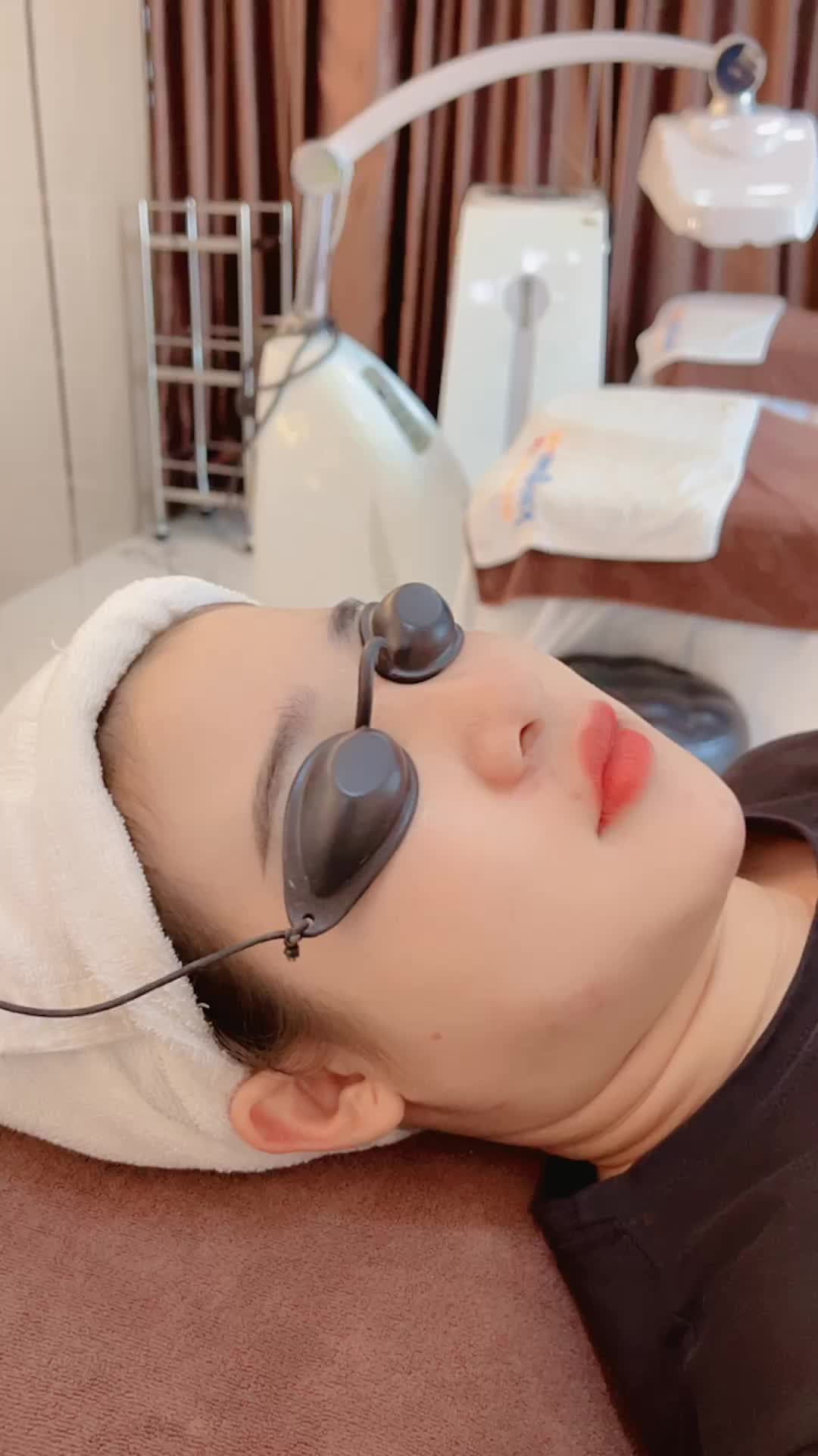 Kết quả sau khi điều trị mụn viêm buổi thứ 3 tại Kangnam với công nghệ De Acne