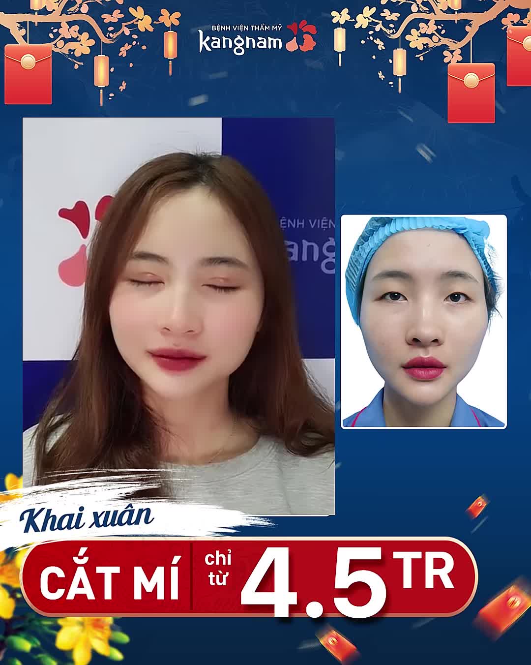 Feedback khách hàng CẮT MÍ sau 7 ngày