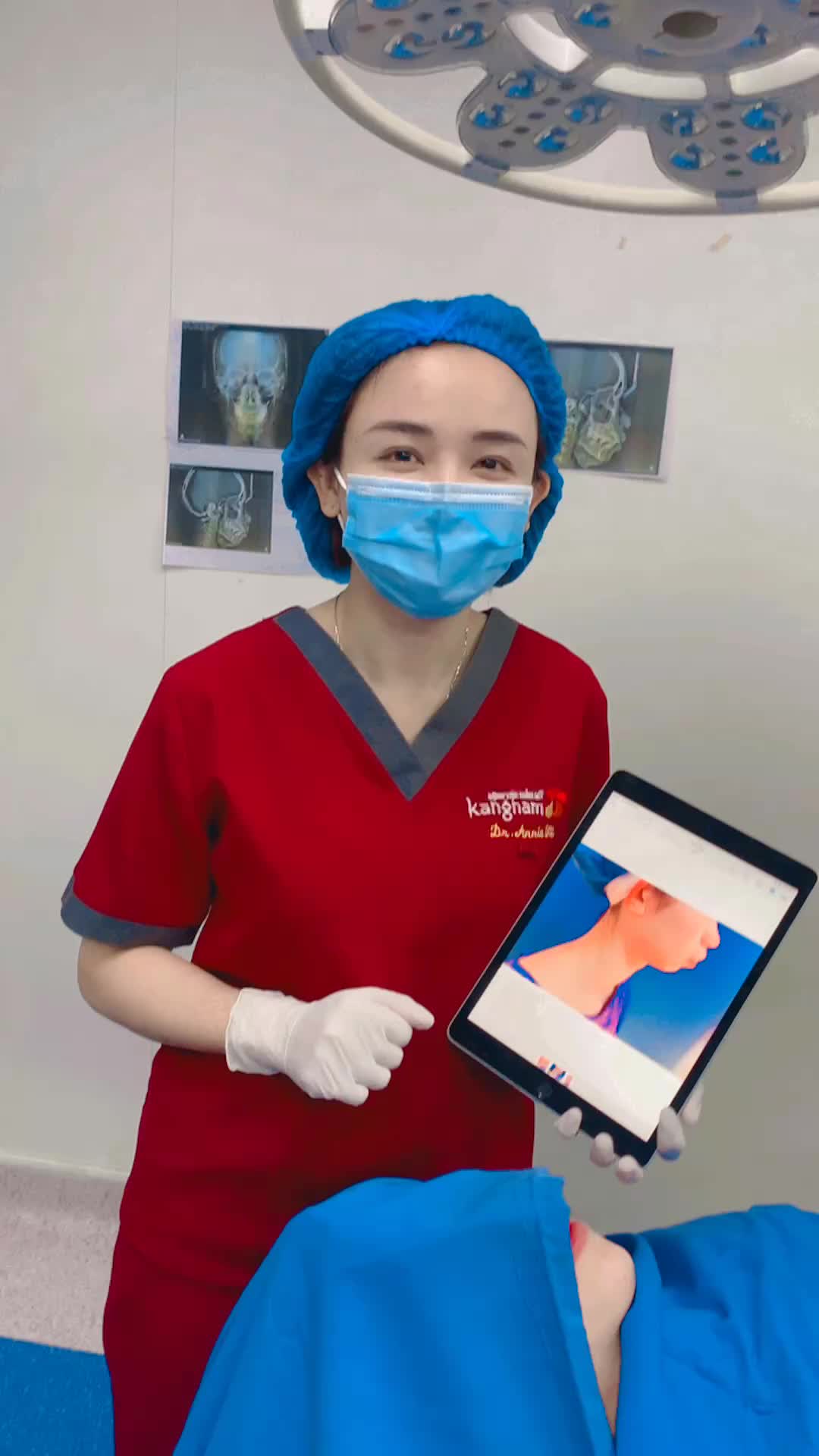 Phân tích kế hoạch và kết quả phẫu thuật chỉnh hàm hô 2 hàm và trượt cằm tại Kangnam