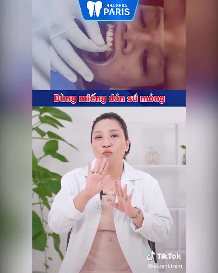 DÁN SỨ VENEER SIÊU MỎNG, SIÊU BỀN, KHÔNG CẦN MÀI RĂNG
