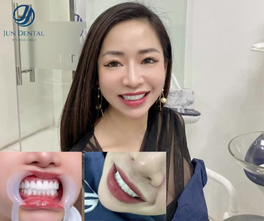 SẮM NỤ CƯỜI ĐẸP VÀ KHỎE CHO TẾT TRỌN VẸN