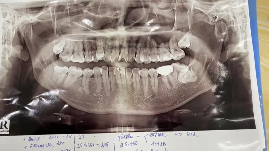 ĐAU KHỚP HÀM, Ù TAI, ĐAU ĐẦU CHỮA TRỊ NHIỀU NƠI TRONG SUỐT 7 NĂM NHƯNG KHÔNG KHỎI