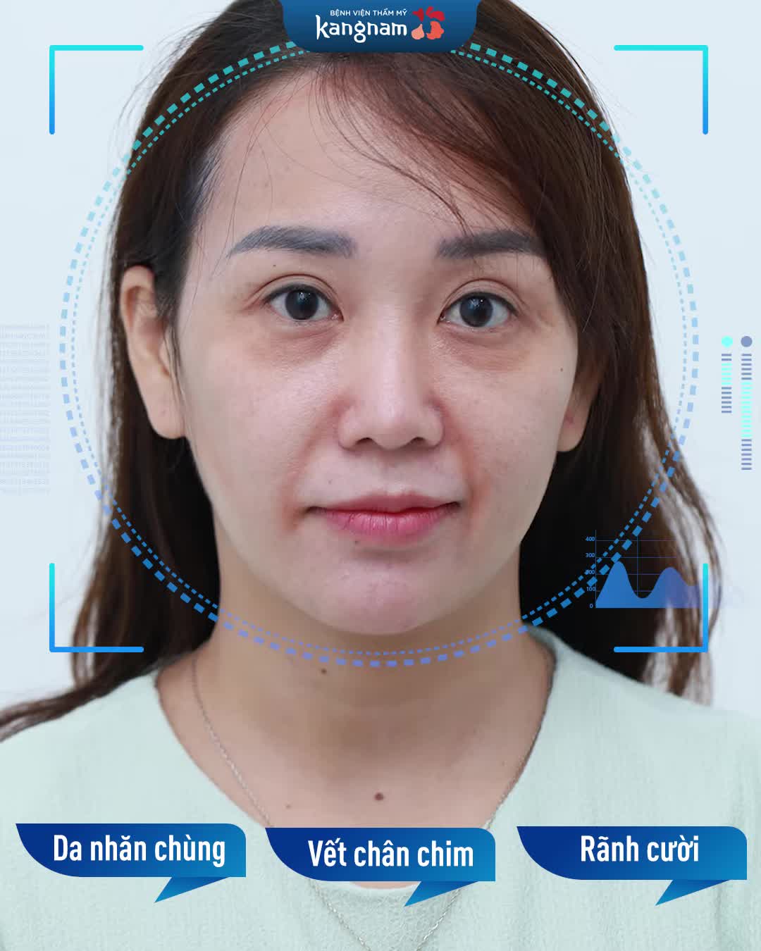 Cấp báo! Tình trạng lão hóa da ngày càng nhiều và sớm hơn ở các chị em