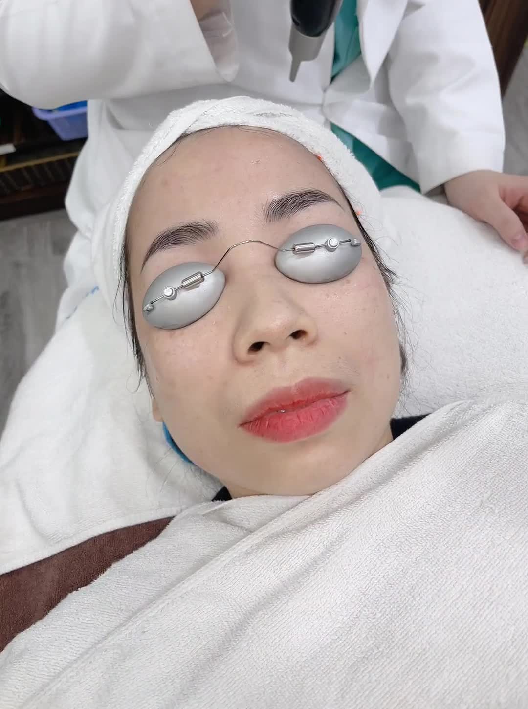 Bật mí cách điều trị tàn nhang chỉ sau 1 buổi