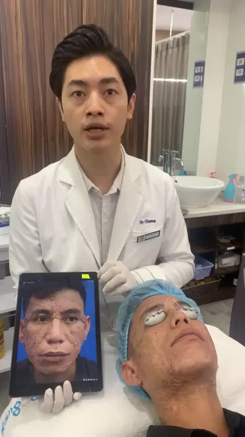 Bạn còn đang lăm tăn điều trị sẹo lồi có hiệu quả?