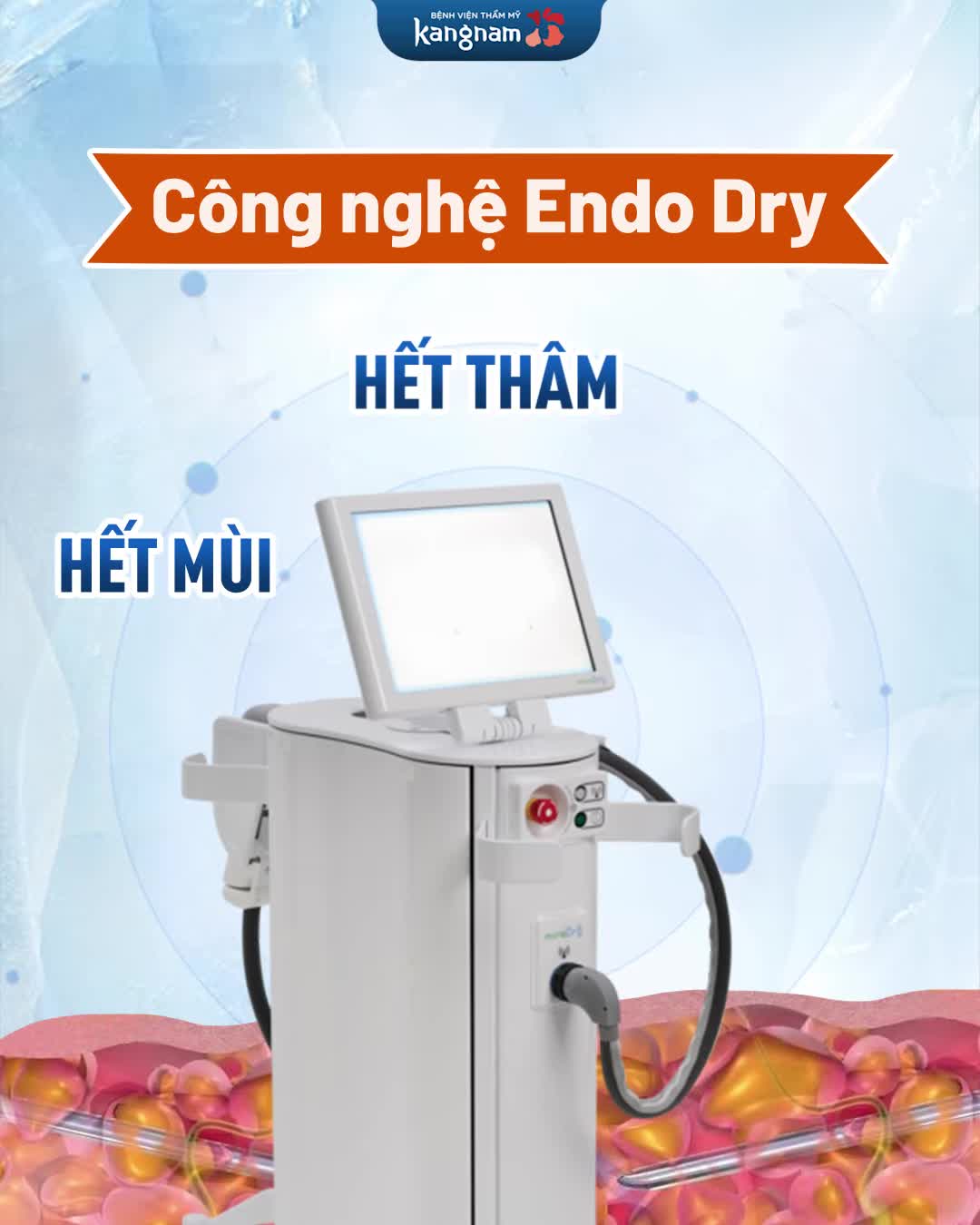 Đi đúng giầy - sẽ không đau chân