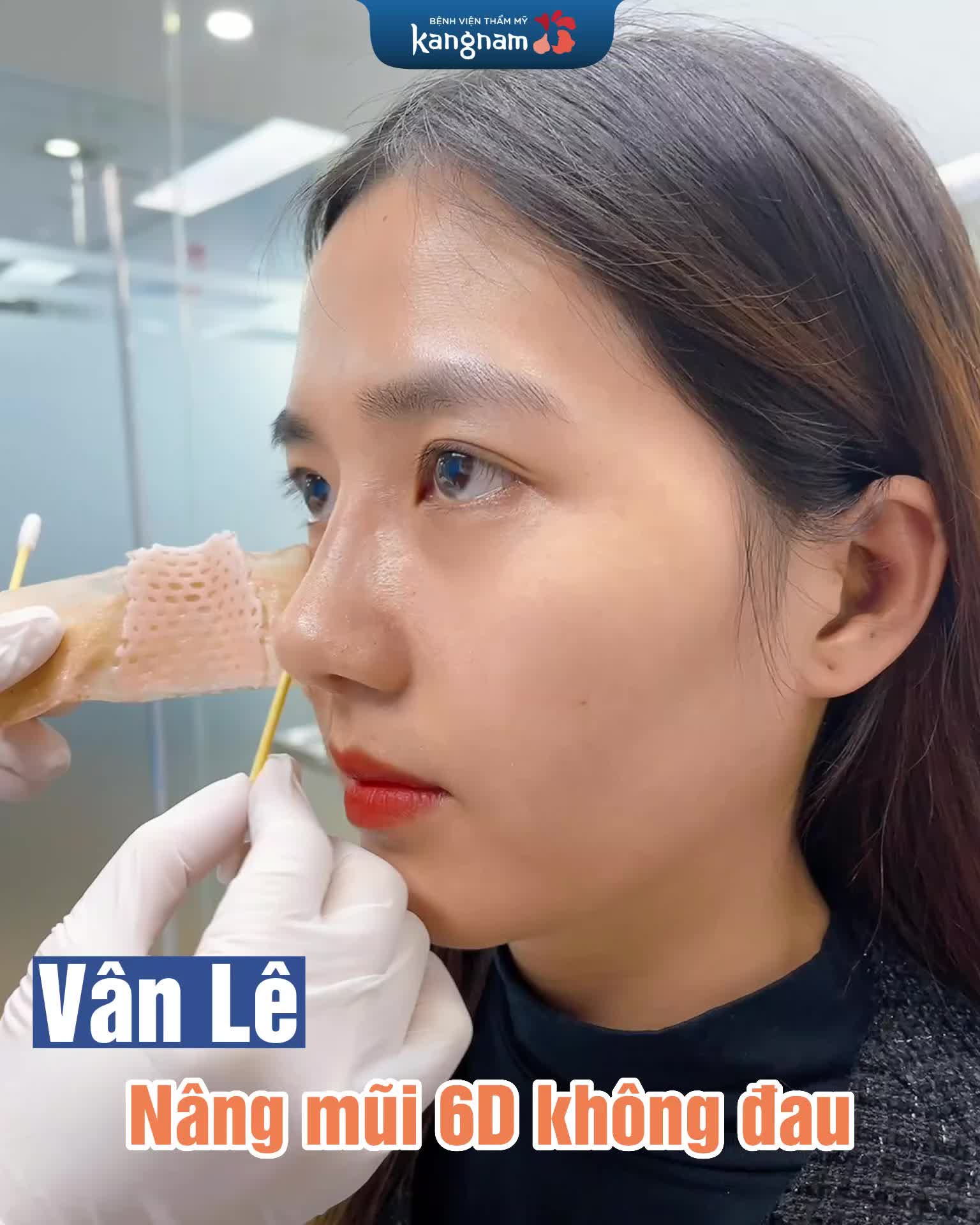 Đúng chuẩn gen Z thích mũi cao là triển ngay không trì hoãn