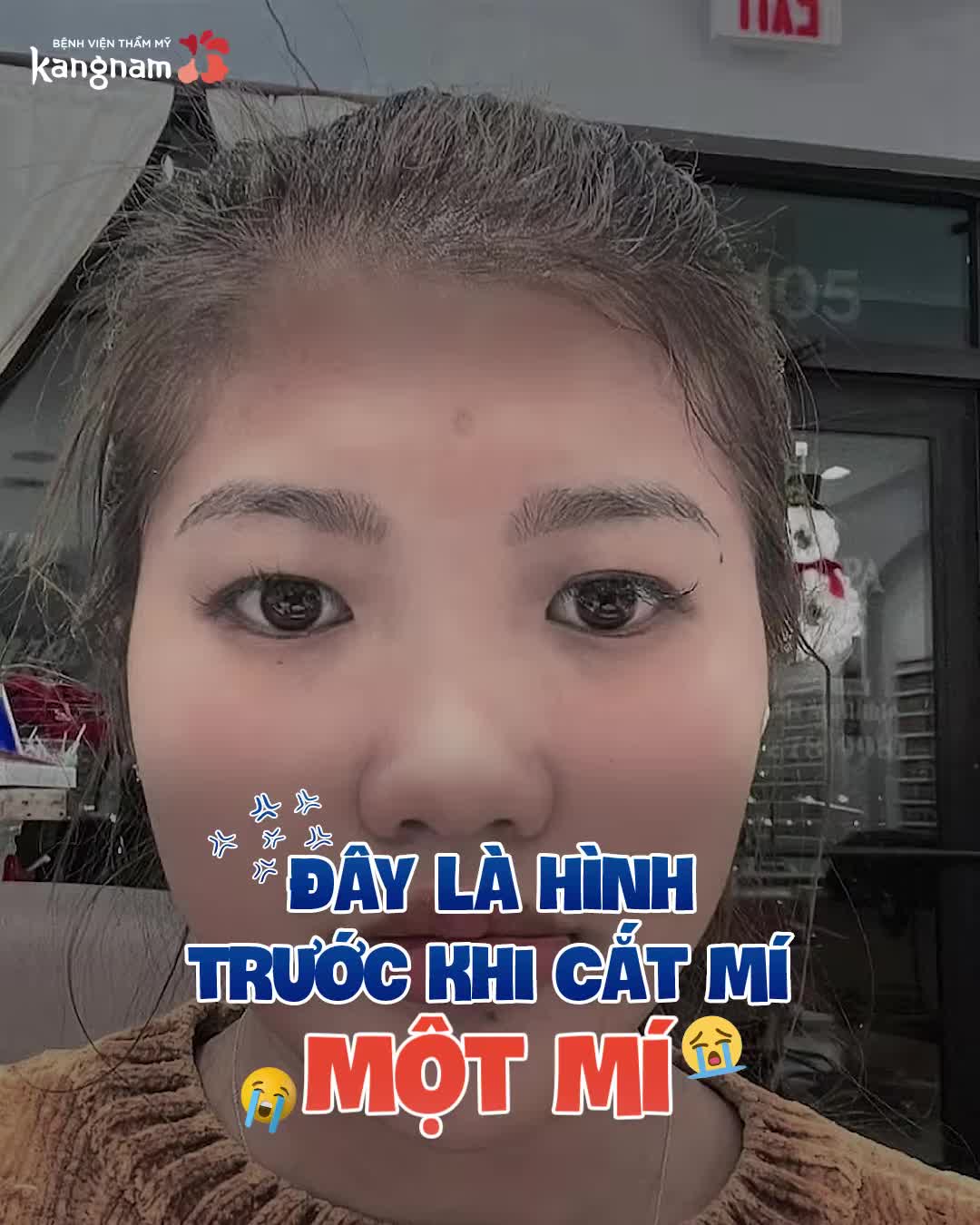 Xem thêm 947 video Cắt Mí của bác sĩ Bs Thẩm Mỹ Kangnam