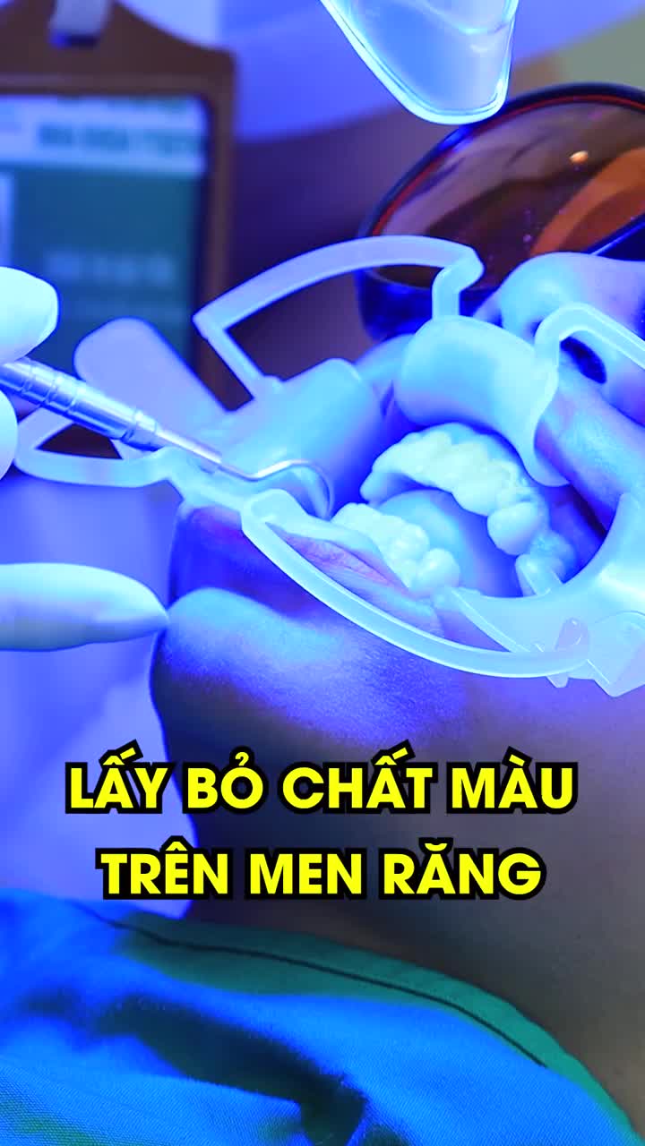Tẩy trắng răng có hại men răng không?