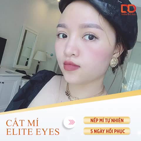 CẮT MÍ 5 NGÀY ĐẸP TỰ NHIÊN - HỒI PHỤC TRƯỚC TẾT