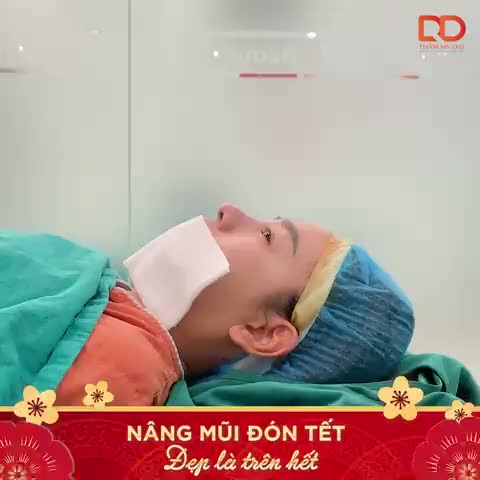 THÀNH QUẢ SAU 60 PHÚT NÂNG MŨI ĐÓN TẾT CHO VỊ KHÁCH VIỆT KIỀU